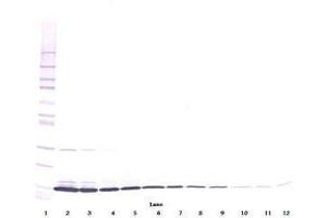Image no. 3 for anti-Interleukin 3 (IL-3) antibody (ABIN464896) (IL-3 antibody)
