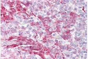 Anti-MARCKS antibody IHC staining of human tonsil. (MARCKS antibody  (AA 136-185))