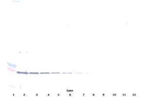 Image no. 1 for anti-Tumor Necrosis Factor Receptor Superfamily, Member 9 (TNFRSF9) antibody (ABIN464902) (CD137 antibody)
