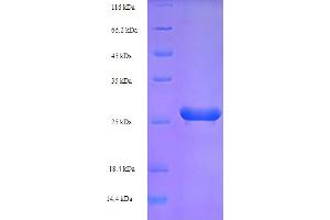 HPV16 E7 Protein (AA 1-99, full length) (His-SUMO Tag)