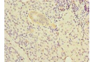 Immunohistochemistry of paraffin-embedded human pancreatic tissue using ABIN7161966 at dilution of 1:100 (Nucleolar Protein 1 (NOL1) (AA 1-210) antibody)