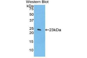 Western blot analysis of the recombinant protein. (SPTAN1 antibody  (AA 1950-2137))