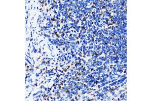 ELAVL1 antibody
