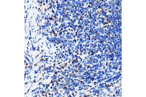 Immunohistochemistry of paraffin-embedded mouse spleen using HuR/EL antibody (ABIN7266913) at dilution of 1:100 (40x lens). (ELAVL1 antibody)