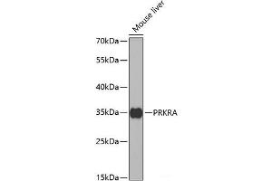Western blot analysis of extracts of Mouse liver using PRKRA Polyclonal Antibody at dilution of 1:1000. (PRKRA antibody)