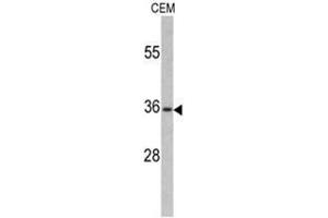 Western blot analysis of PAX4 antibody (Center) in CEM cell line lysates (35ug/lane).