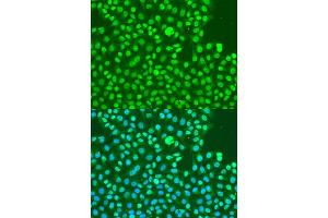 Immunofluorescence analysis of U2OS cells using Phospho-DNA-PKcs-S2056 antibody (ABIN6135292, ABIN6136206, ABIN6136207 and ABIN6225632) at dilution of 1:100. (PRKDC antibody  (pSer2056))