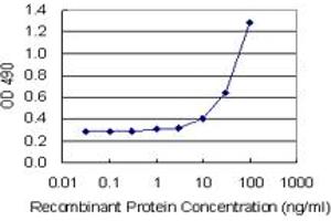 Sandwich ELISA detection sensitivity ranging from 10 ng/mL to 100 ng/mL. (TAGLN (Human) Matched Antibody Pair)