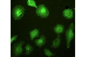 Detection of IL1RL1 in A549 cells using Polyclonal Antibody to Interleukin 1 Receptor Like Protein 1 (IL1RL1) (IL1RL1 antibody  (AA 162-349))