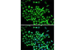 Immunofluorescence analysis of A-549 cells using Cullin 2 antibody (ABIN6129299, ABIN6139249, ABIN6139250 and ABIN6220930). (Cullin 2 antibody  (AA 40-310))