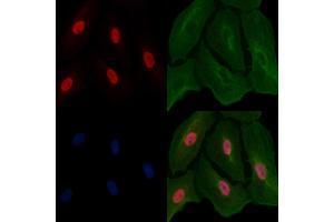 ABIN6261157 and ABIN6266615 staining  cells by IF/ICC. (Cyclin L1 antibody  (C-Term))