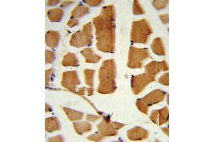 Formalin-fixed and paraffin-embedded human skeletal muscle reacted with BMI1 Antibody , which was peroxidase-conjugated to the secondary antibody, followed by DAB staining. (BMI1 antibody  (C-Term))
