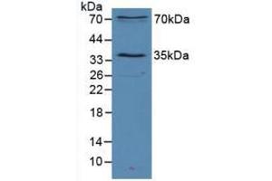 Western blot analysis of Mouse Heart Tissue. (SIRT2 antibody  (AA 65-340))