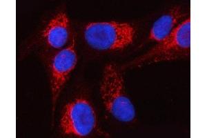 IF analysis of PTPIP51/RMDN3 using anti-PTPIP51/RMDN3 antibody (ABIN7601775). (RMDN3 antibody  (AA 45-438))