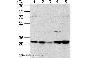 Western blot analysis of 293T and MCF7 cell, mouse brain tissue and K562 cell, mouse bladder tissue, using TPD52L2 Polyclonal Antibody at dilution of 1:400 (TPD52L2 antibody)