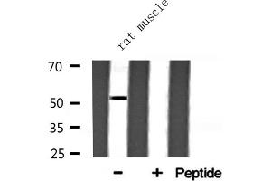 Western blot analysis of ARMC6 expression in Rat muscle lysate (ARMC6 antibody  (C-Term))