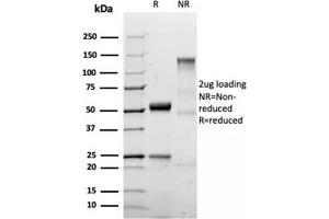 SDS-PAGE Analysis Purified S100B Recombinant Rabbit Monoclonal Antibody (S100B/1706R). (Recombinant S100B antibody)
