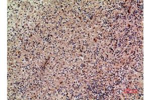 Immunohistochemistry (IHC) analysis of paraffin-embedded Human Liver, antibody was diluted at 1:100. (XCL1 antibody  (Internal Region))
