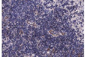 ABIN6267261 at 1/200 staining human lymph node tissue sections by IHC-P. (EGFR antibody  (pSer1070))