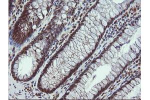 Immunohistochemistry (IHC) image for anti-ALX Homeobox 4 (ALX4) antibody (ABIN1496621) (ALX4 antibody)