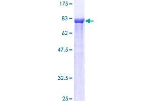 ETV6 Protein (AA 1-452) (GST tag)