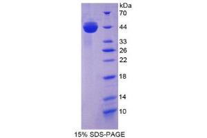 SDS-PAGE (SDS) image for Glutamic-Oxaloacetic Transaminase 1, Soluble (Aspartate Aminotransferase 1) (GOT1) (AA 1-413) protein (His tag) (ABIN1078918) (GOT1 Protein (AA 1-413) (His tag))