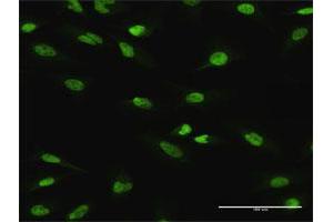 Immunofluorescence of purified MaxPab antibody to ATF1 on HeLa cell. (AFT1 antibody  (AA 1-271))
