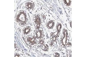Immunohistochemical staining of human breast with ECHDC3 polyclonal antibody  shows moderate granular cytoplasmic positivity in glandular cells at 1:200-1:500 dilution. (ECHDC3 antibody)
