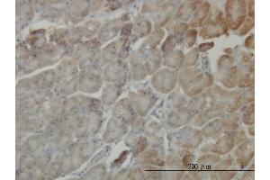 Immunoperoxidase of monoclonal antibody to RP6-213H19. (STK26/MST4 antibody  (AA 1-137))