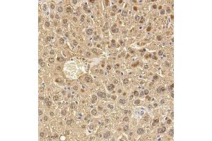 Immunohistochemistry of paraffin embedded mouse liver using Regucalcin (ABIN7075393) at dilution of 1:700 (300x lens) (Regucalcin antibody)