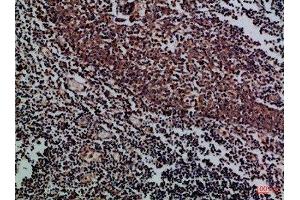 Immunohistochemical analysis of paraffin-embedded Human-tonsil, antibody was diluted at 1:100 (KIR2DL5A antibody  (AA 31-80))