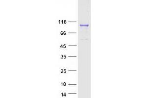 Validation with Western Blot