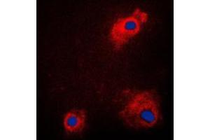 Immunofluorescent analysis of GSK3 alpha (pS21) staining in PC12 cells. (GSK3 alpha antibody  (N-Term, pSer21))