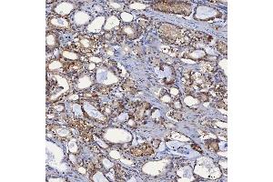 IHC analysis of SBP/SELENBP1 using anti-SBP/SELENBP1 antibody (ABIN7600755). (SELENBP1 antibody  (AA 23-462))