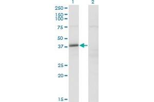Western Blot analysis of FAM62B expression in transfected 293T cell line by FAM62B monoclonal antibody (M02), clone 4C3.