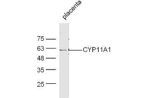 Mouse placenta lysates probed with Rabbit Anti-CYP11A1 Polyclonal Antibody, Unconjugated  at 1:500 for 90 min at 37˚C. (CYP11A1 antibody  (AA 321-420))