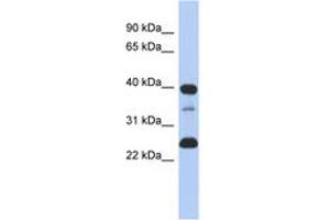 Image no. 1 for anti-Thymopoietin (TMPO) (N-Term) antibody (ABIN6743330) (Thymopoietin antibody  (N-Term))