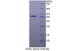 SDS-PAGE (SDS) image for Granzyme A (Granzyme 1, Cytotoxic T-Lymphocyte-Associated serine Esterase 3) (GZMA) (AA 29-262) protein (His tag) (ABIN1879813) (GZMA Protein (AA 29-262) (His tag))