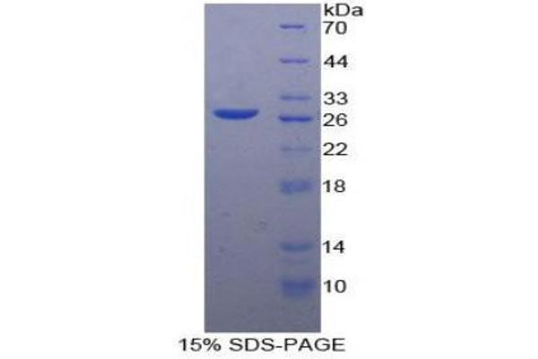GZMA Protein (AA 29-262) (His tag)