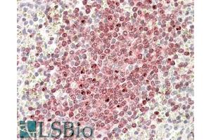 In paraffin embedded Human Spleen shows nuclear staining in the germinal center with stronger nucleoli staining in some of the B cells. (POU2AF1 antibody  (C-Term))
