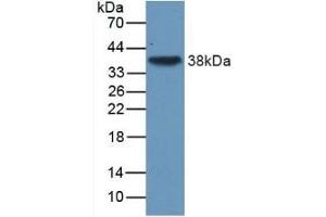 Detection of Recombinant TGFb3, Human using Monoclonal Antibody to Transforming Growth Factor Beta 3 (TGFb3) (TGFB3 antibody  (AA 24-300))