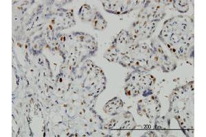 Immunohistochemistry (Formalin-fixed Paraffin-embedded Sections) (IHC (fp)) image for anti-Geminin, DNA Replication Inhibitor (GMNN) (AA 110-209) antibody (ABIN565518)