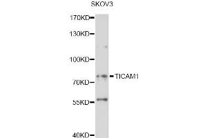 Western blot analysis of extracts of SKOV3 cells, using TICAM1 antibody (ABIN6292307) at 1:1000 dilution. (TICAM1 antibody)