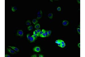 Immunofluorescent analysis of MCF-7 cells using ABIN7175630 at dilution of 1:100 and Alexa Fluor 488-congugated AffiniPure Goat Anti-Rabbit IgG(H+L) (VN1R2 antibody  (AA 115-170))