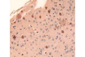 IHC-P analysis of brain tissue, with DAB staining. (Cathepsin L antibody  (AA 18-113))
