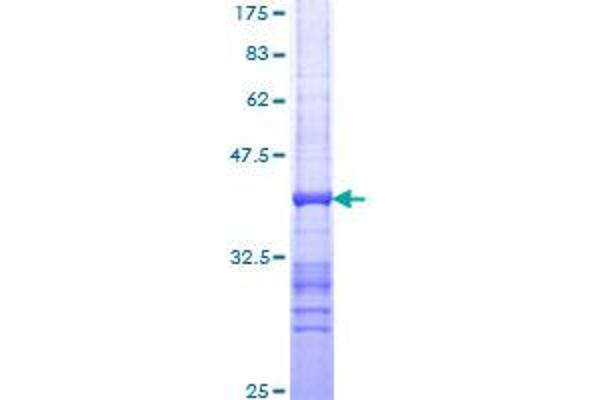 TPT1 Protein (AA 35-138) (GST tag)