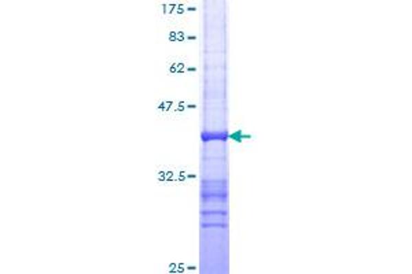 TPT1 Protein (AA 35-138) (GST tag)