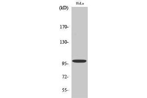 Western Blotting (WB) image for anti-Catenin-alpha E/N (C-Term) antibody (ABIN3183680) (Catenin-alpha E/N (C-Term) antibody)