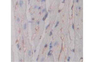 Immunohistochemistry (IHC) image for anti-Tumor Necrosis Factor Receptor Superfamily, Member 10b (TNFRSF10B) (AA 54-180) antibody (ABIN1860800)