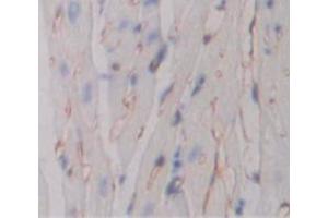 Figure. (TNFRSF10B antibody  (AA 54-180))